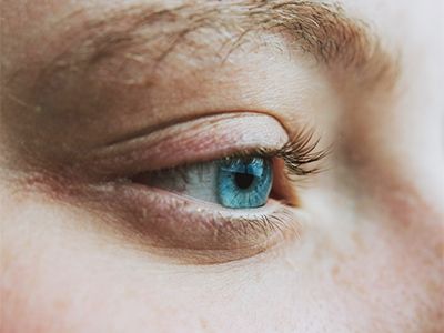 Trockenes Auge (Sicca-Syndrom)